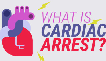 Why Do Cardiac Arrests Happen? - Infographic