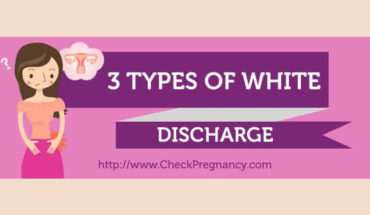 Shades of White: 3 Types of Vaginal Discharge - Infographic