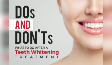 Essential Guide to Post Teeth Whitening Care: 8 Important Do’s and Don’ts - Infographic